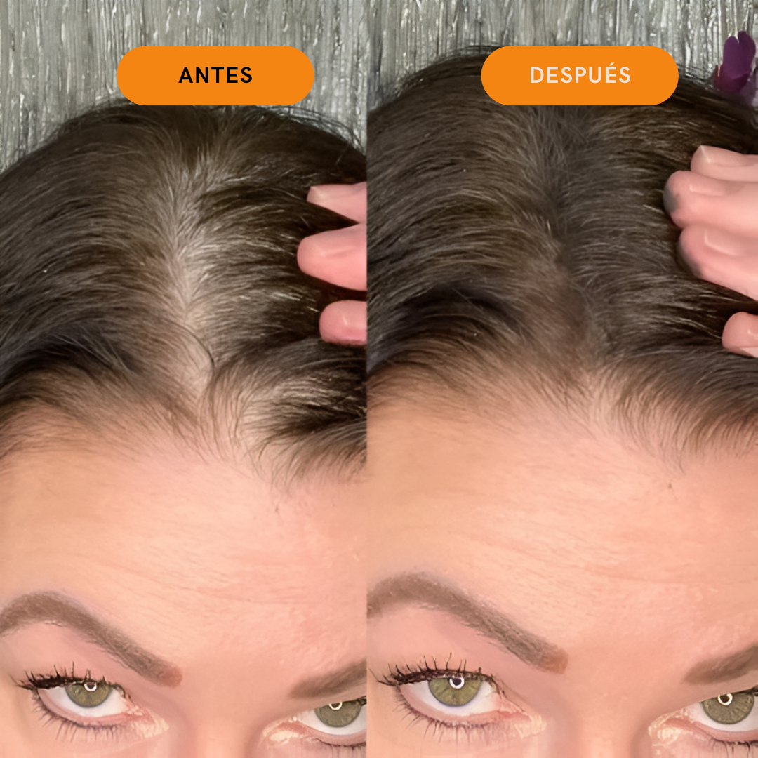 Retoque de cabello para las raices - Hair Line Fix™