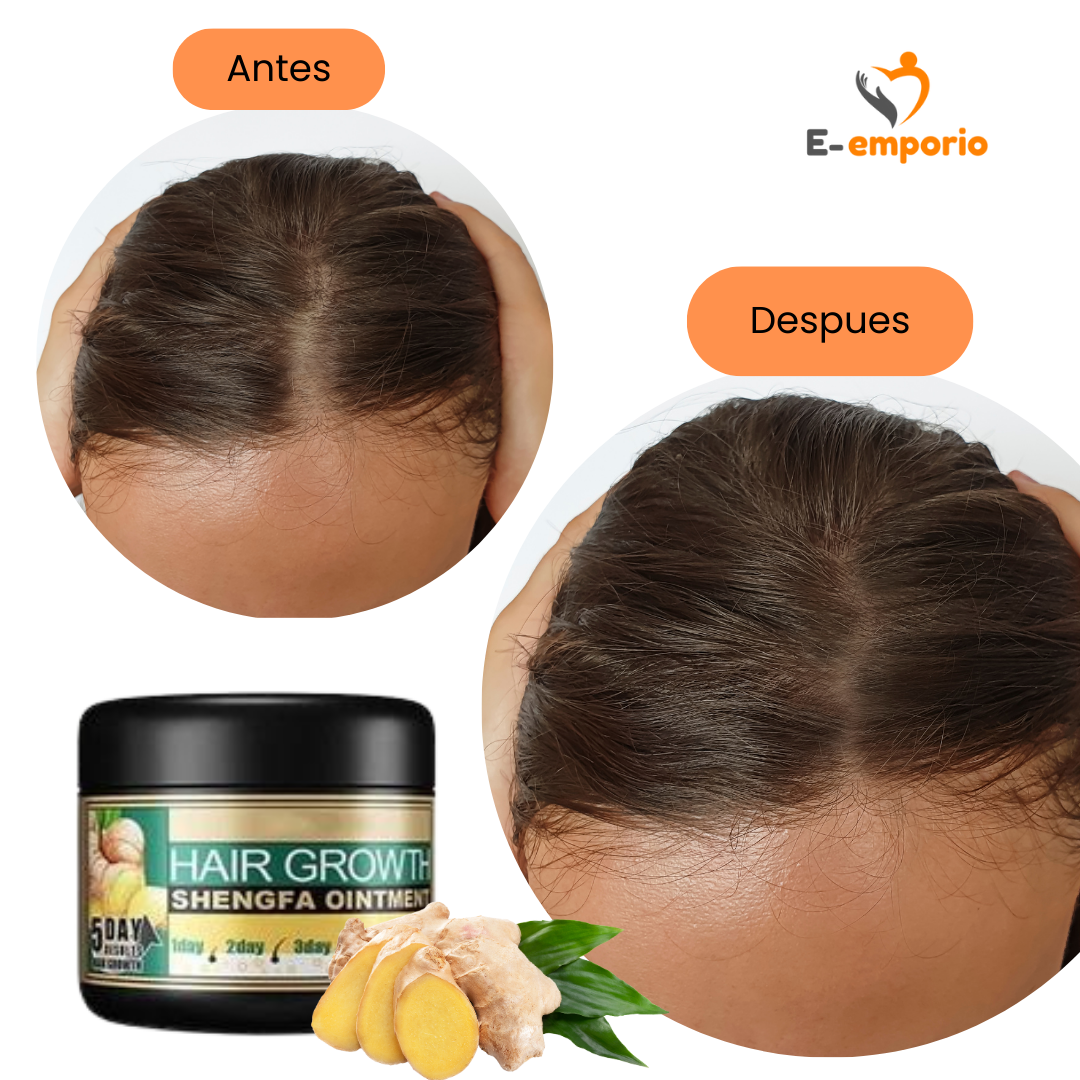 Crema de Jengibre® -adiós a la caída en 1 semana